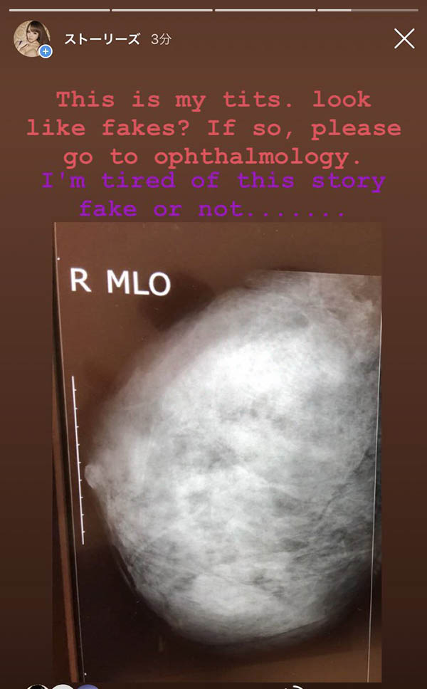 图片[4]-暗黑第一球霸《Hitomi》精选作品推荐介绍及封面预览-艾尤社